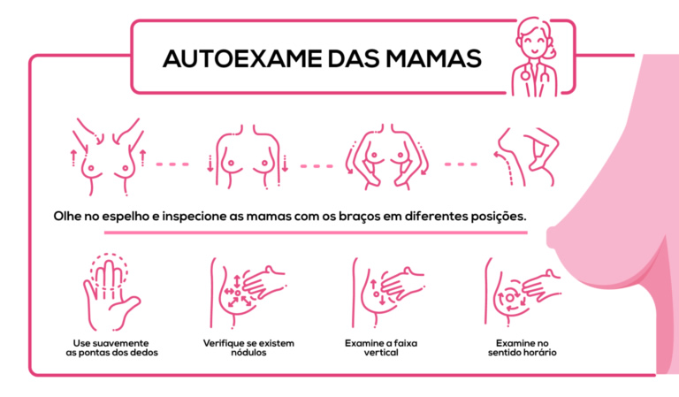 autoexame das mamas - cancer de mama